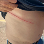 Ferimento sofrido pelo policial (Foto: CGN ) 